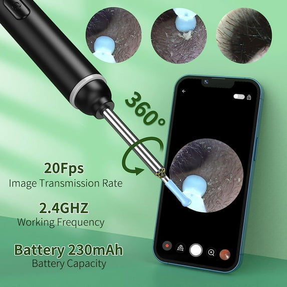 Ear Wax Removal Tool, 1920P HD Ear Cleaner with 6 LED Lights, 3mm Mini Visual Ear Camera, Ear Cleaning Kit for iPhone, iPad, Android